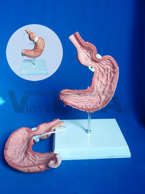 Stomach model in 2 parts with Gastric Band (replica)